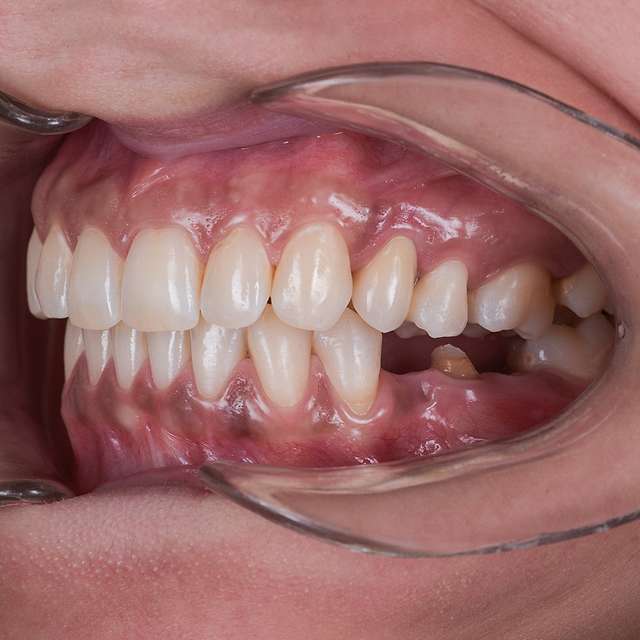 precision-dental